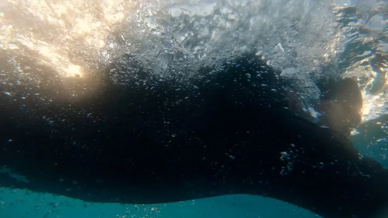 Refractive Lens Exchange (RLE) Surgery Moorfields London UK · Alex Day