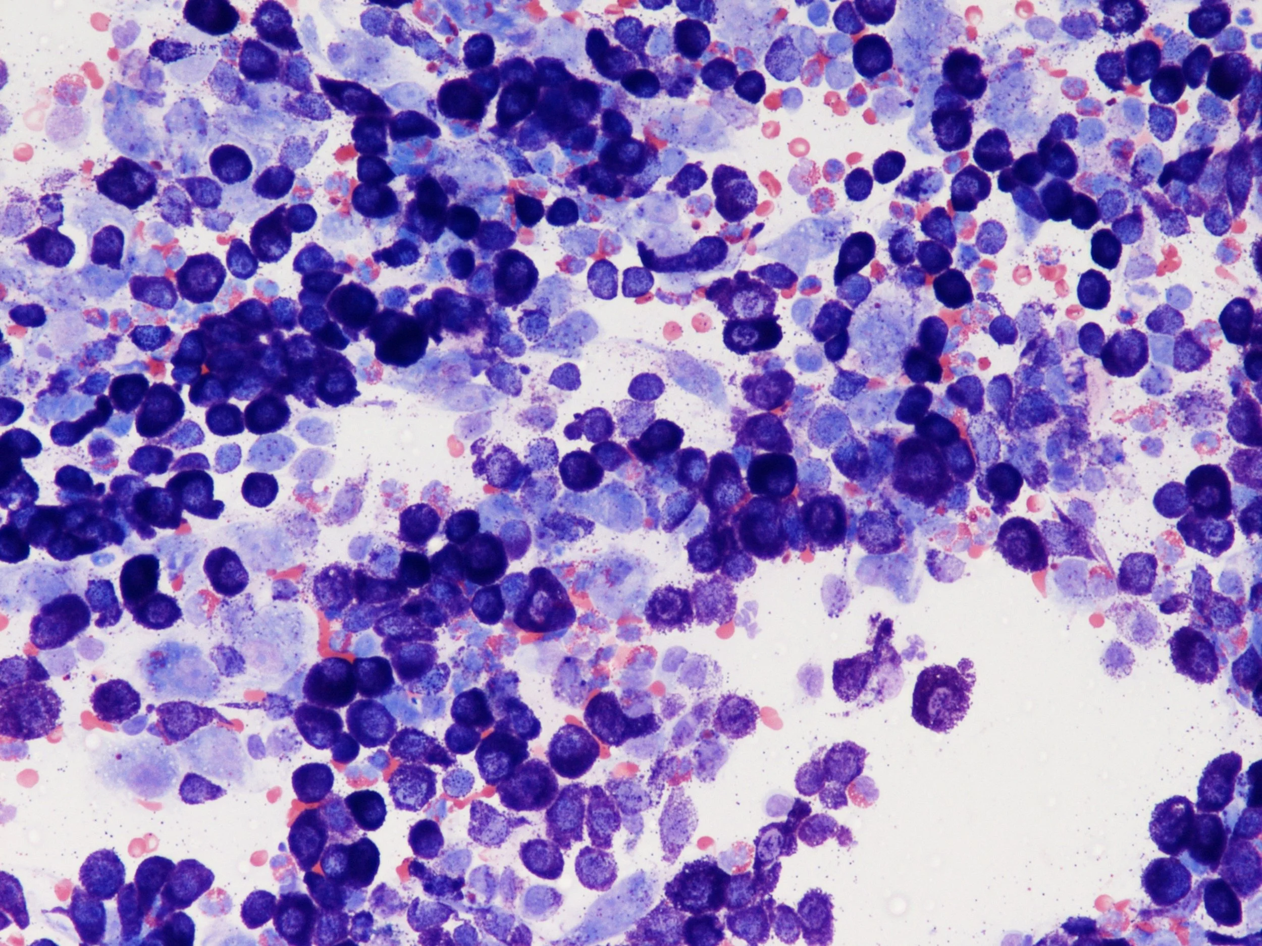 Microscope image of stained cells with purple nuclei and pink cytoplasm.