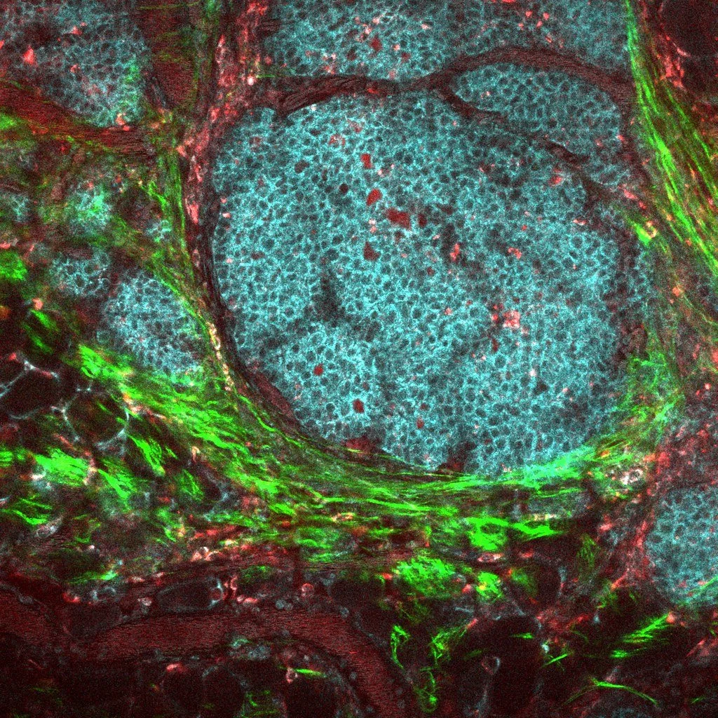 Fluorescent microscopy image showing a complex arrangement of cells. The cells are primarily cyan, surrounded by networks of green and red coloring, indicating different structures or markers.