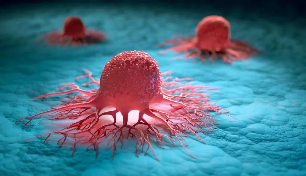 Illustration of cancer cells spreading in tissue, showing red tumor-like structures with tentacle-like projections on a blue surface.