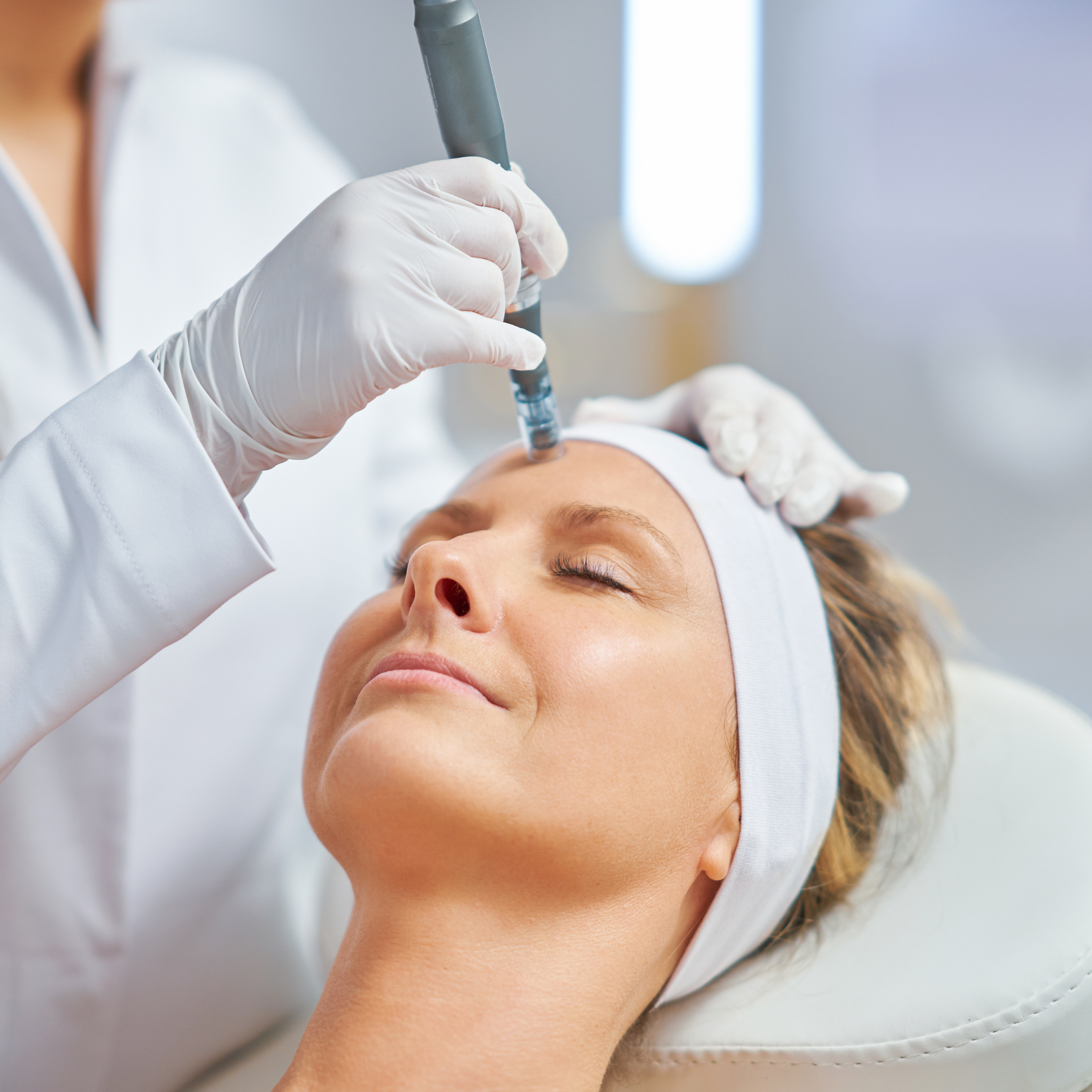 SkinPen Microneedling with PRF Ashburn