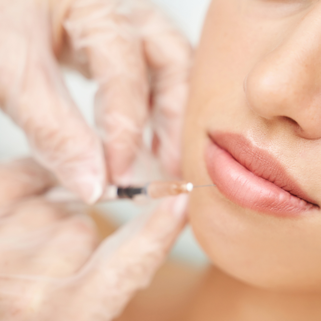 Northern Virginia Ashburn Restylane filler injections