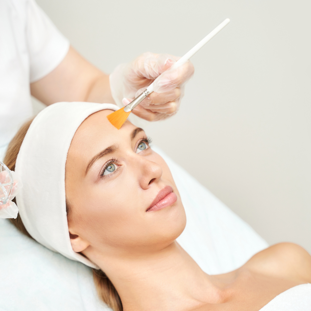 chemical VI peels results washington dc