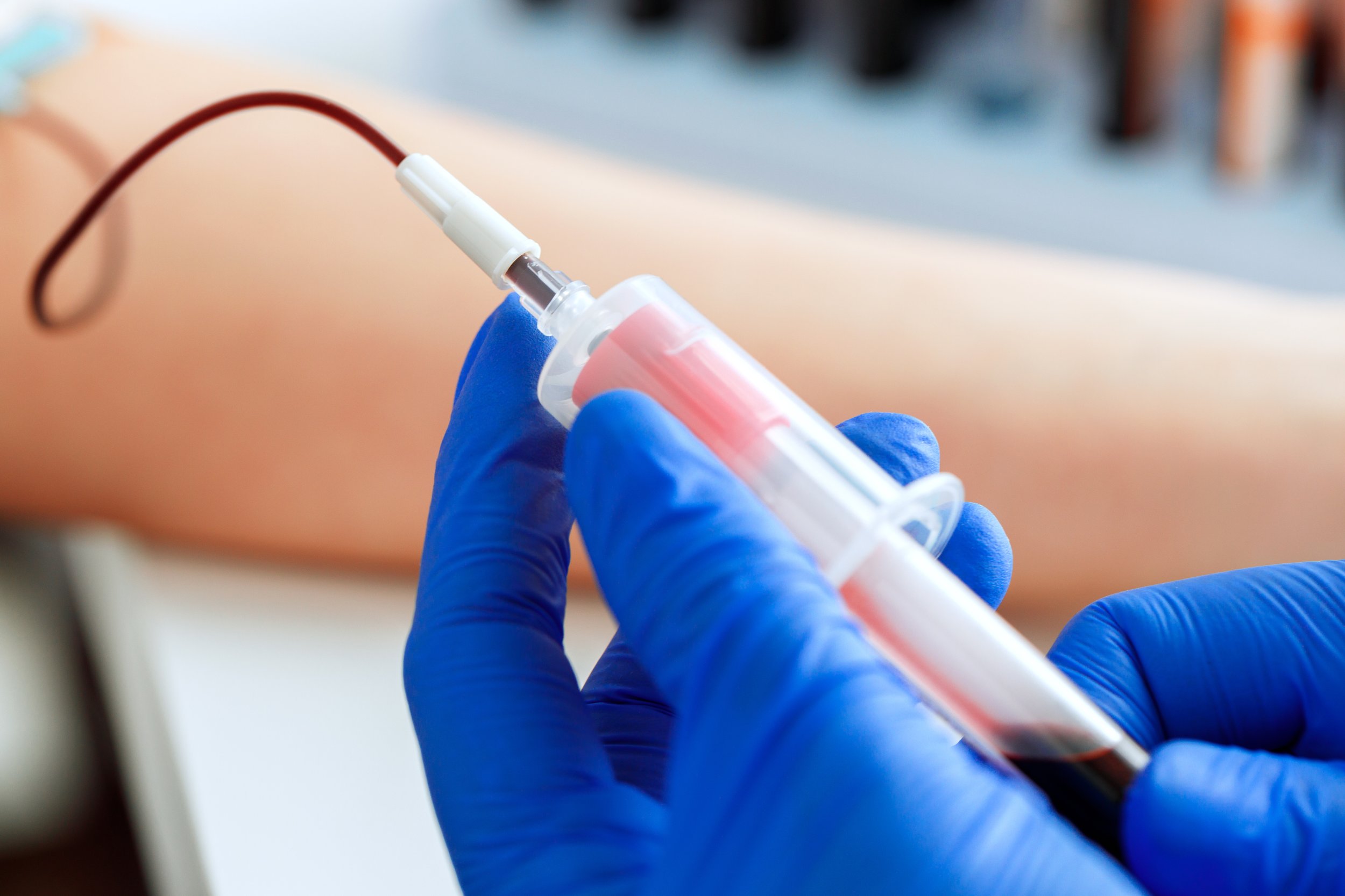 Química sanguínea: el estudio clave para detectar diabetes, colesterol y problemas metabólicos