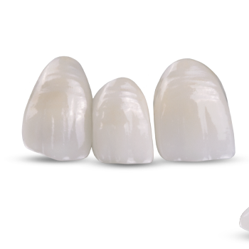 Close-up of three white dental veneers or crowns on a black background.