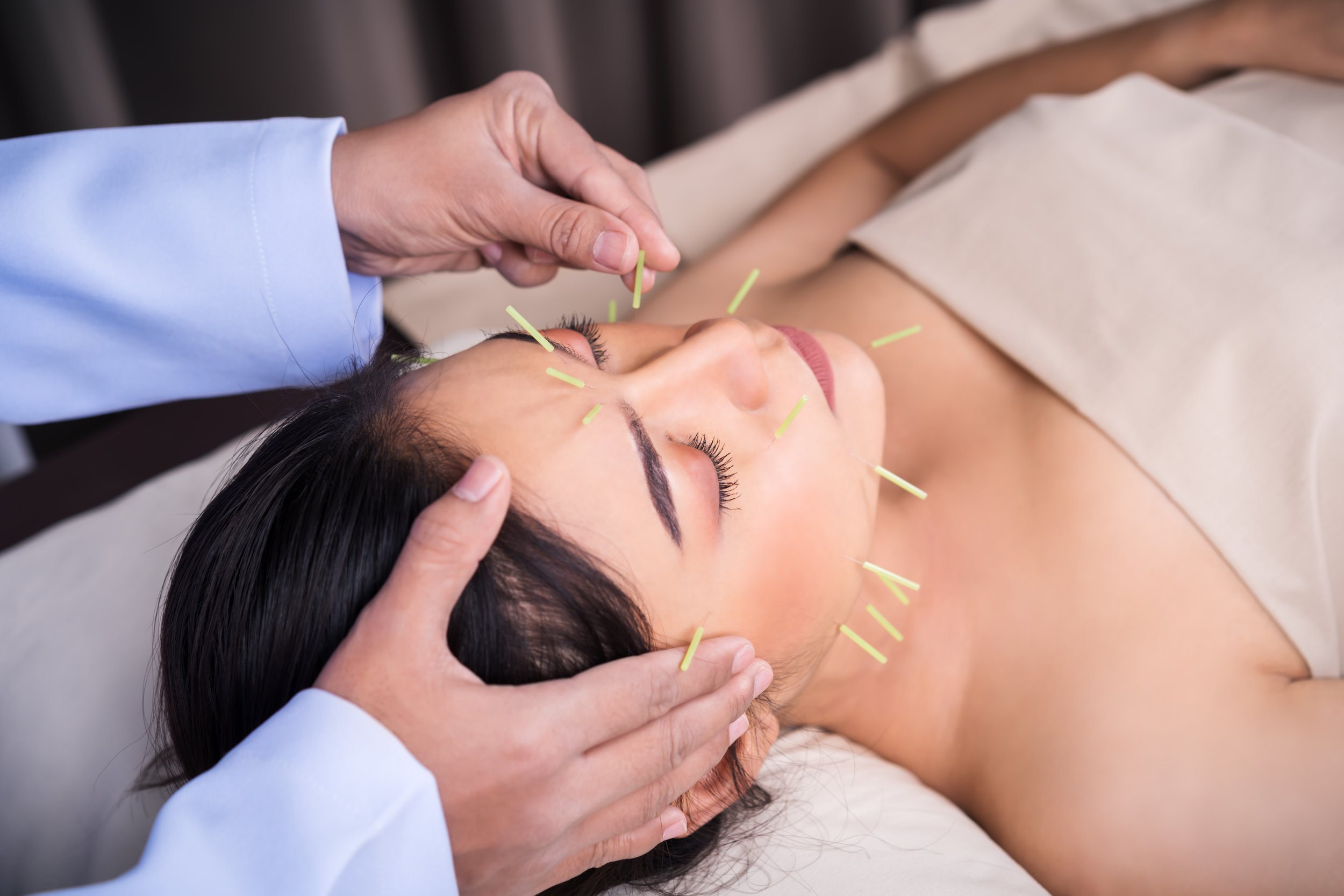 Facial Acupuncture Benefits: A Natural Approach to Skin Rejuvenation, Collagen Support &amp; Whole-Body Wellness