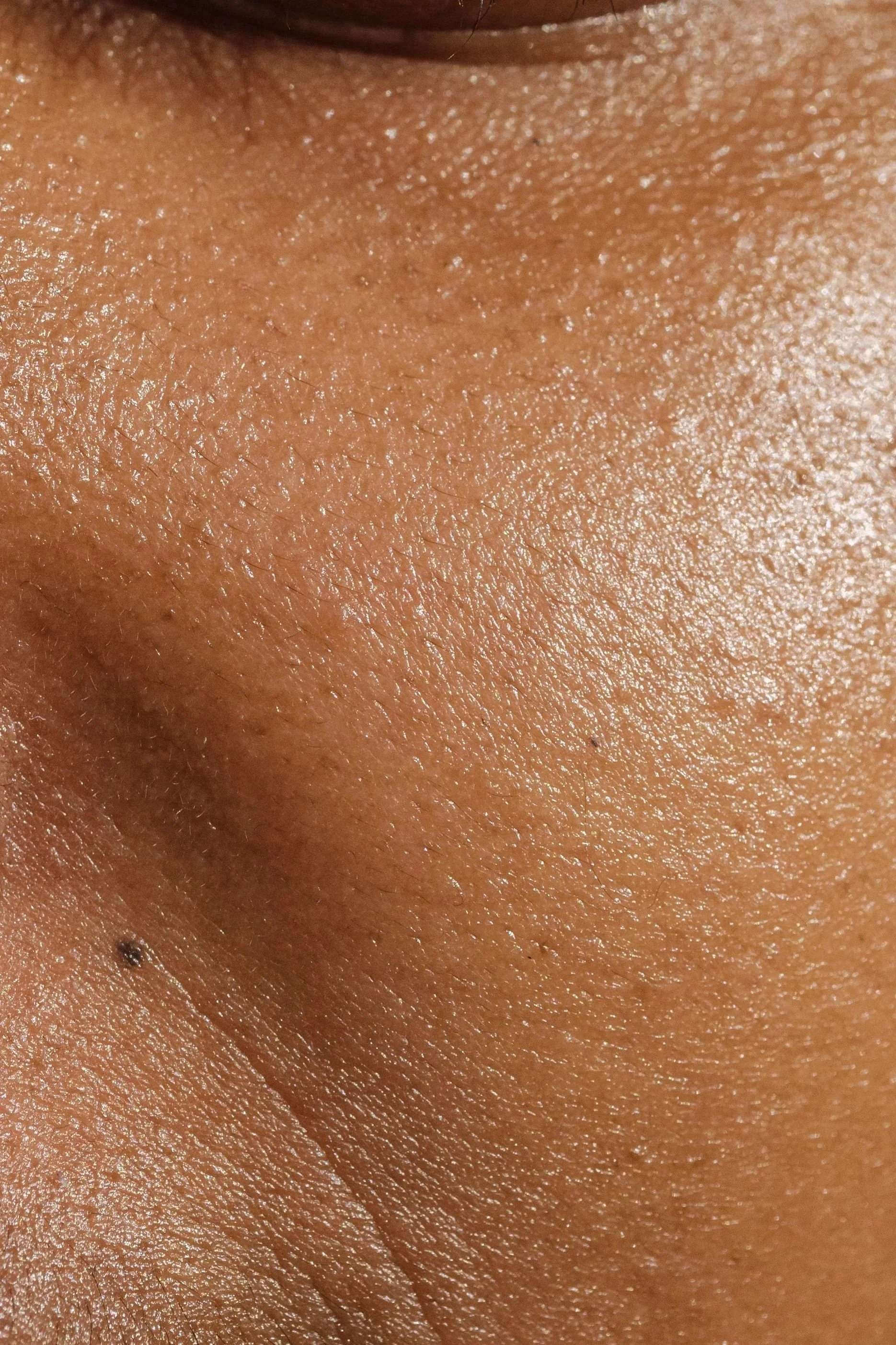 Your Skin is Shiny and Feels Oily