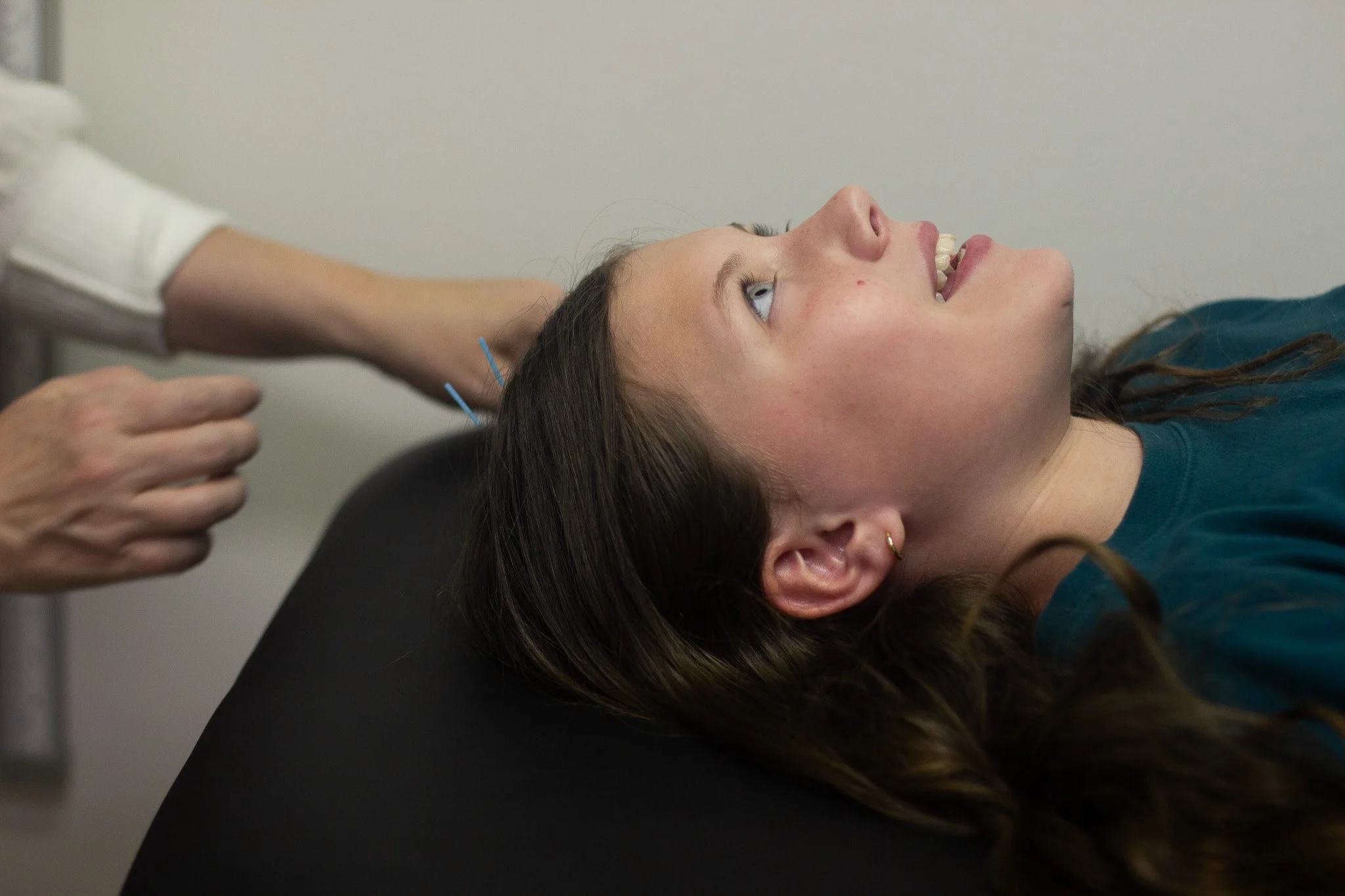 Acupuncture — Dr. Jennifer Dilts