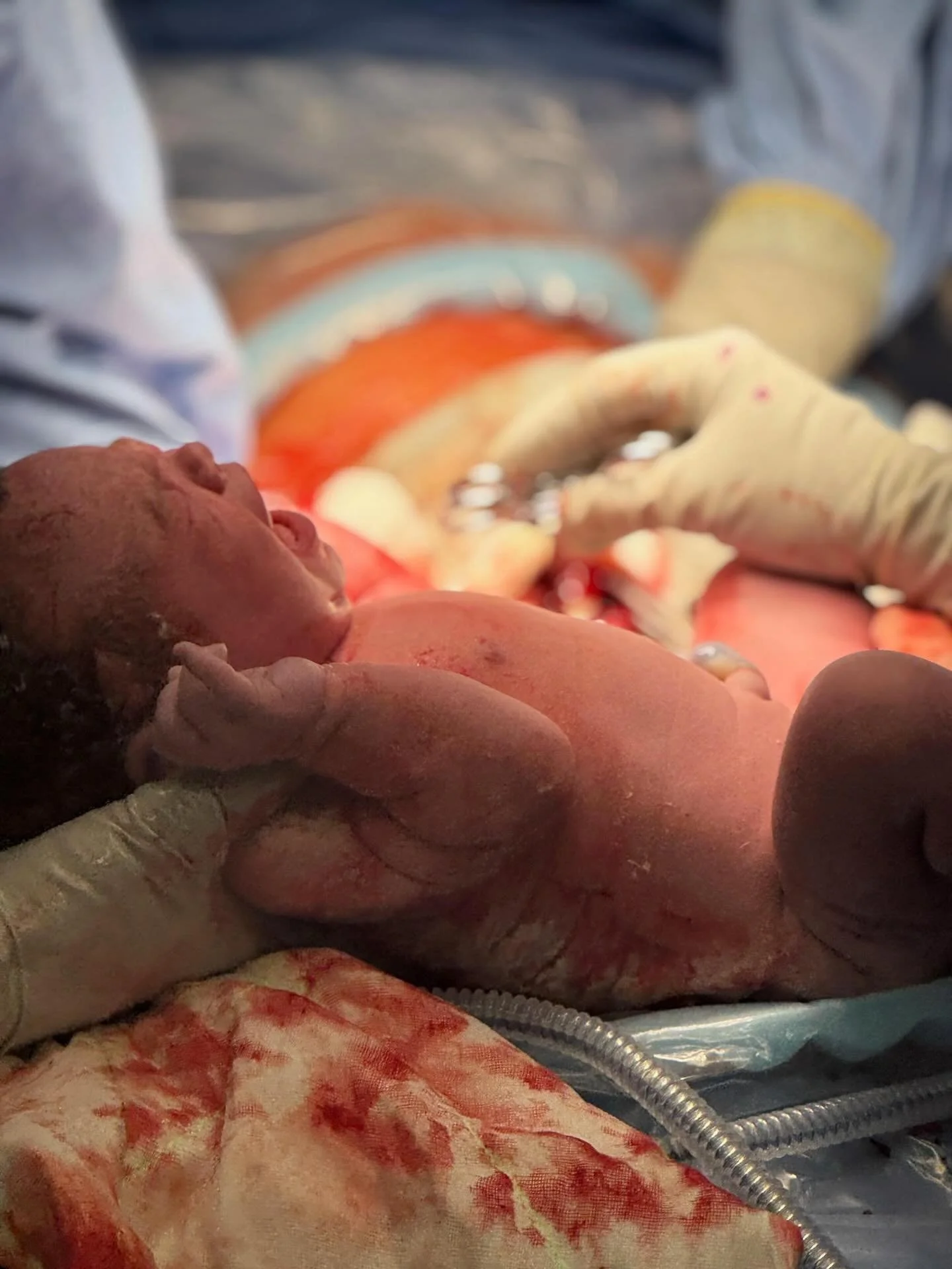 The birth blog is back ✨ 

A beautiful story by mumma Molly. 

A calm and supported C-section after an attempted VBAC ❣️ 

&ldquo;After my check, my OB looked at me and said, &ldquo;Your cervix is closed.&rdquo; 
I couldn&rsquo;t stop laughing. I sim