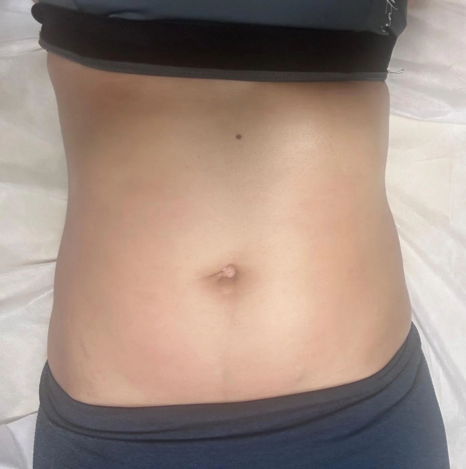 Body sculpting massage