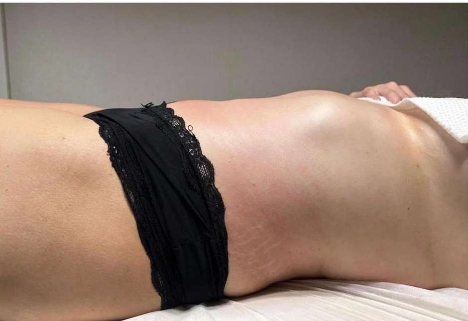 body sculpting massage