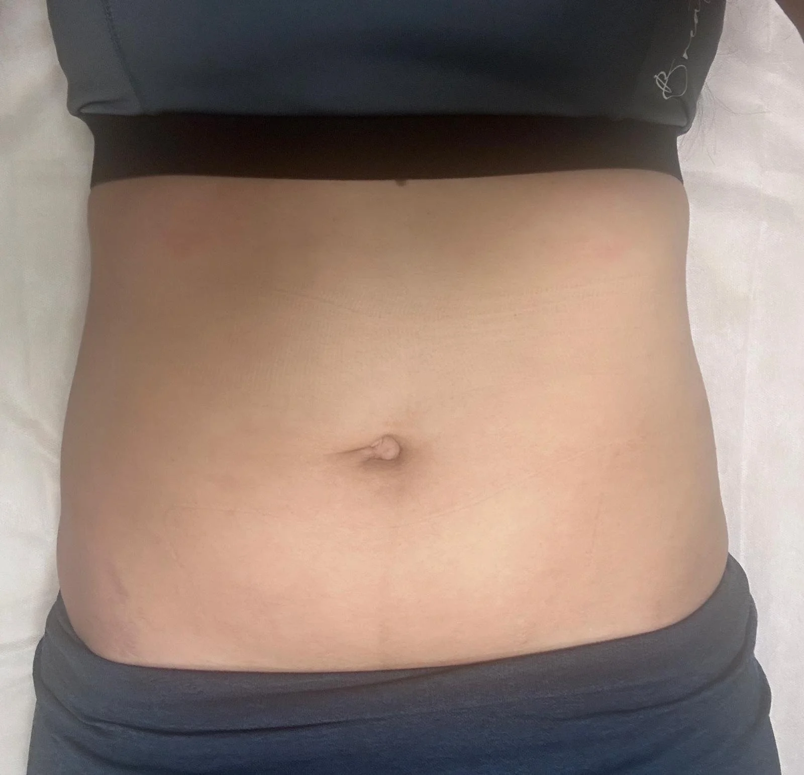 Body sculpting massage