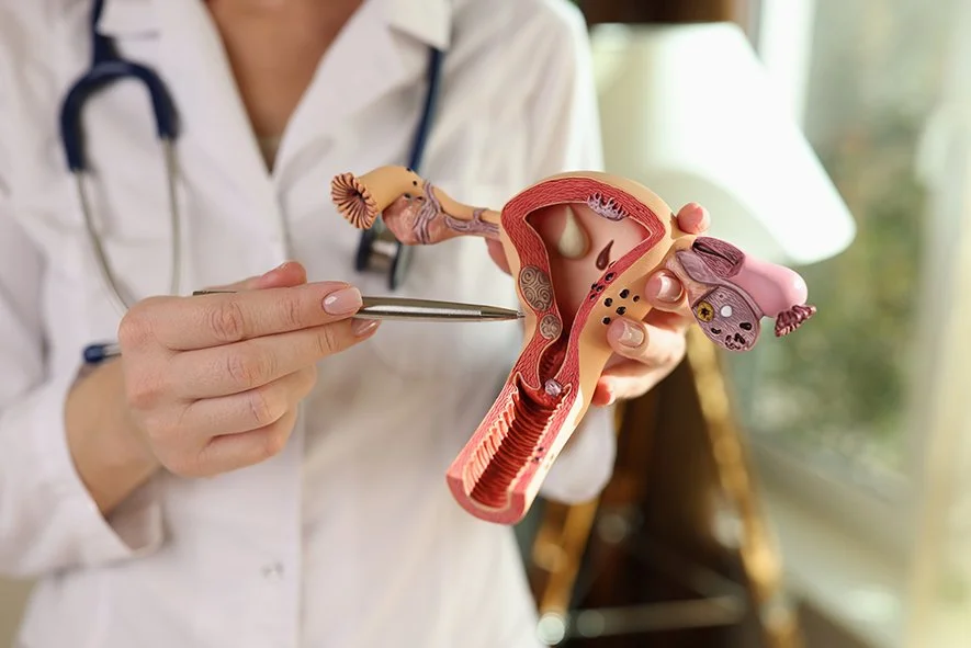 Removing the Tubes First – The New Frontier in Ovarian Cancer Prevention?