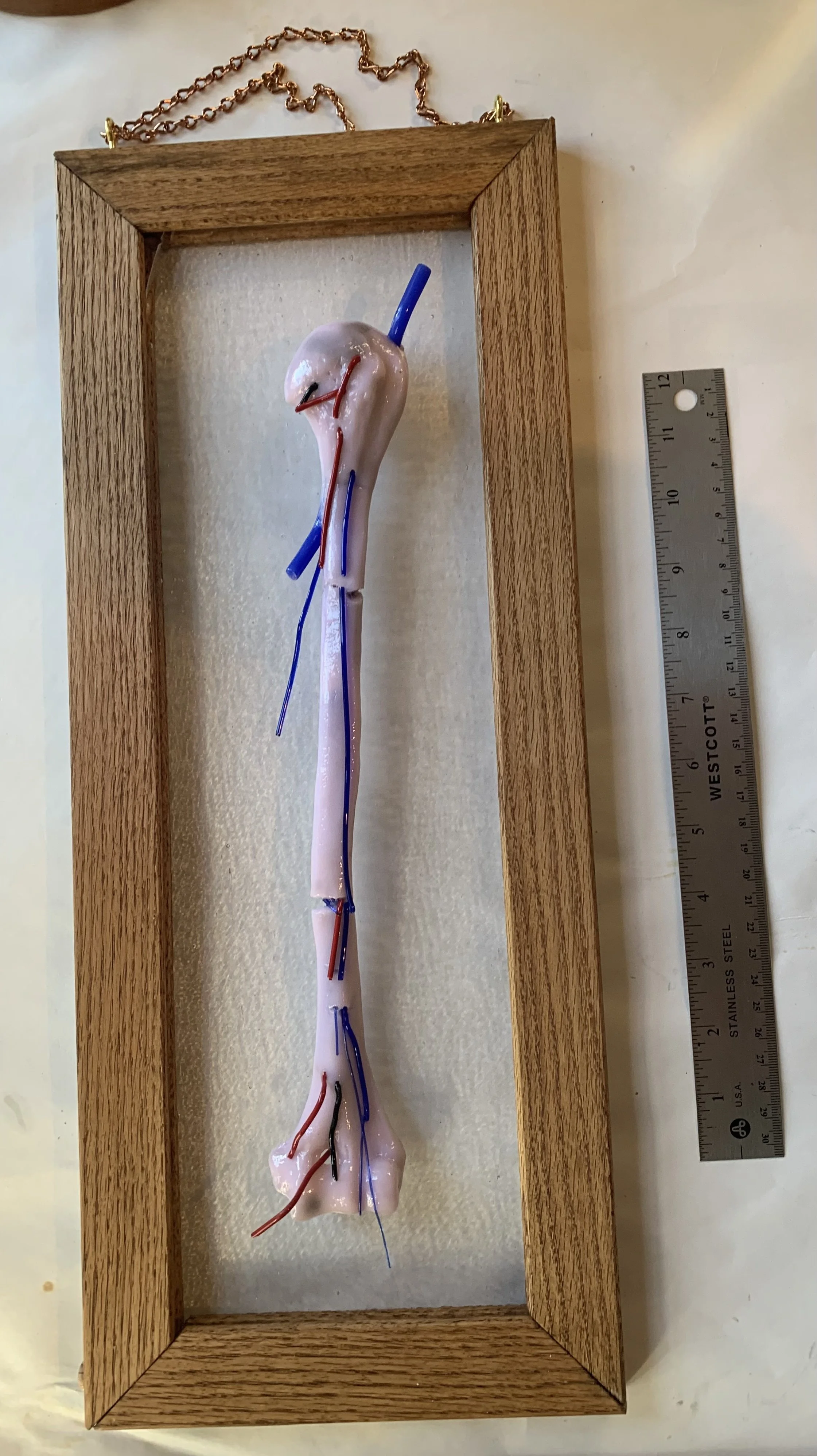 Roseus Vascularis F Umerus by Peter Janes