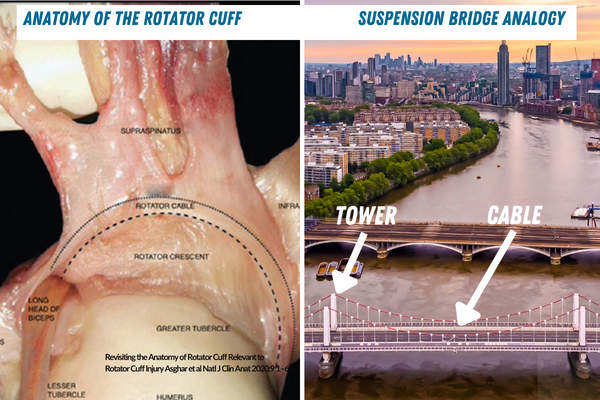 Your Rotator Cuff Tear Isn't What You Think, St. Louis, MO