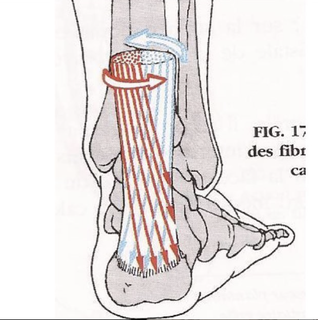 Diagram of the Achilles tendon showing the direction of fiber bundlesl, with arrows indicating the orientation of the fibers.