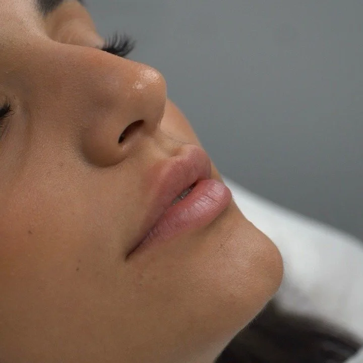 Med Spa in Sheepshead Bay, Brooklyn, NY