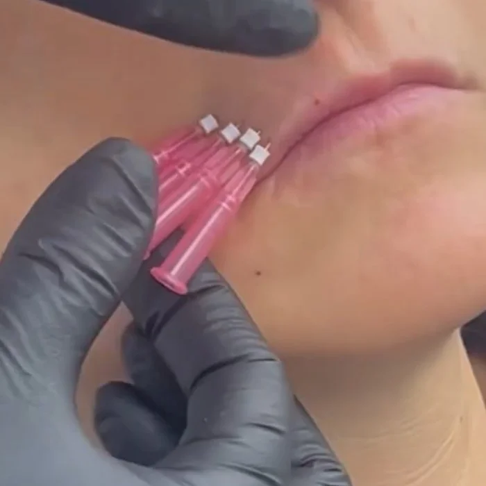 PDO Threads in Homecrest, Brooklyn, NY