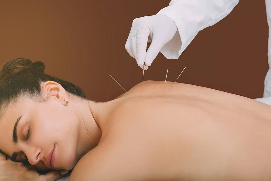 Acupuncture treatment with sterile needles at Firm Medical Spa in Tulsa
