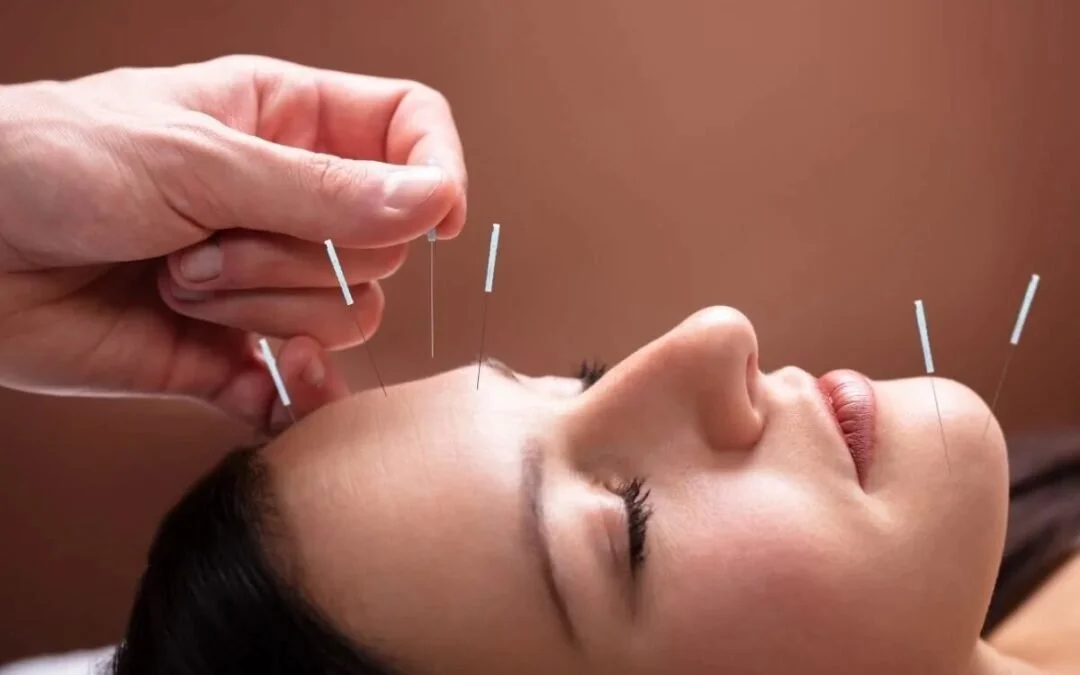 Acupuncture treatment at Firm Medical Spa in Tulsa