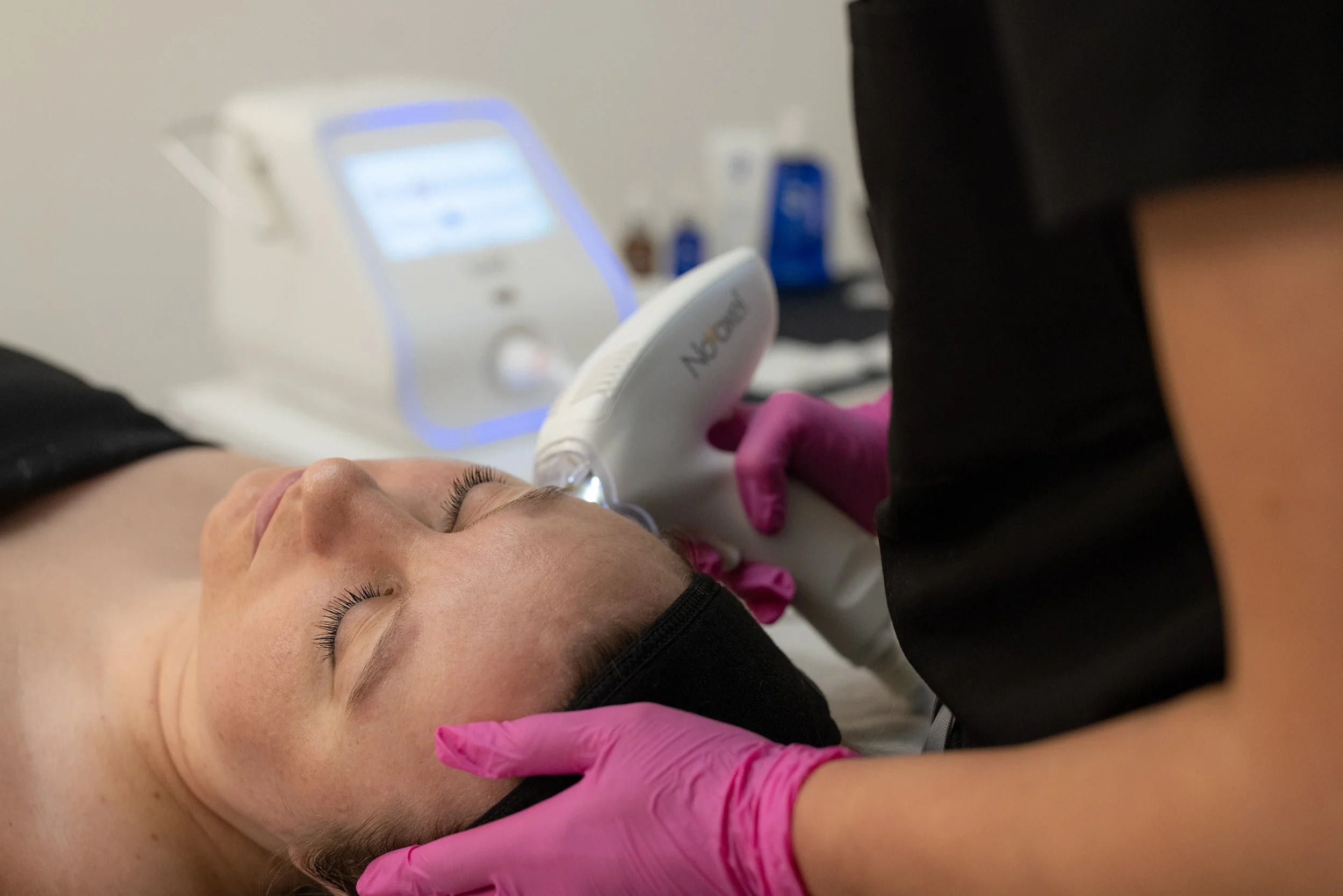 Tixel skin resurfacing treatment at Firm Medical Spa in Tulsa.