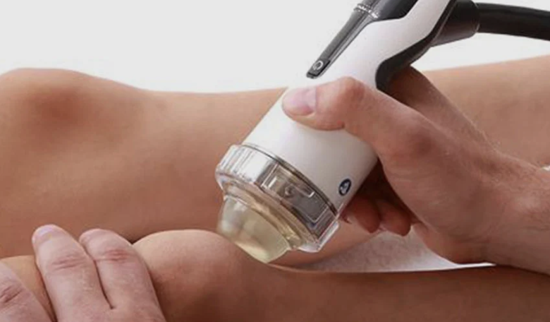 The Complete Guide to Shockwave Therapy: How It Works, Who It’s For, and When It Outperforms Traditional Treatments