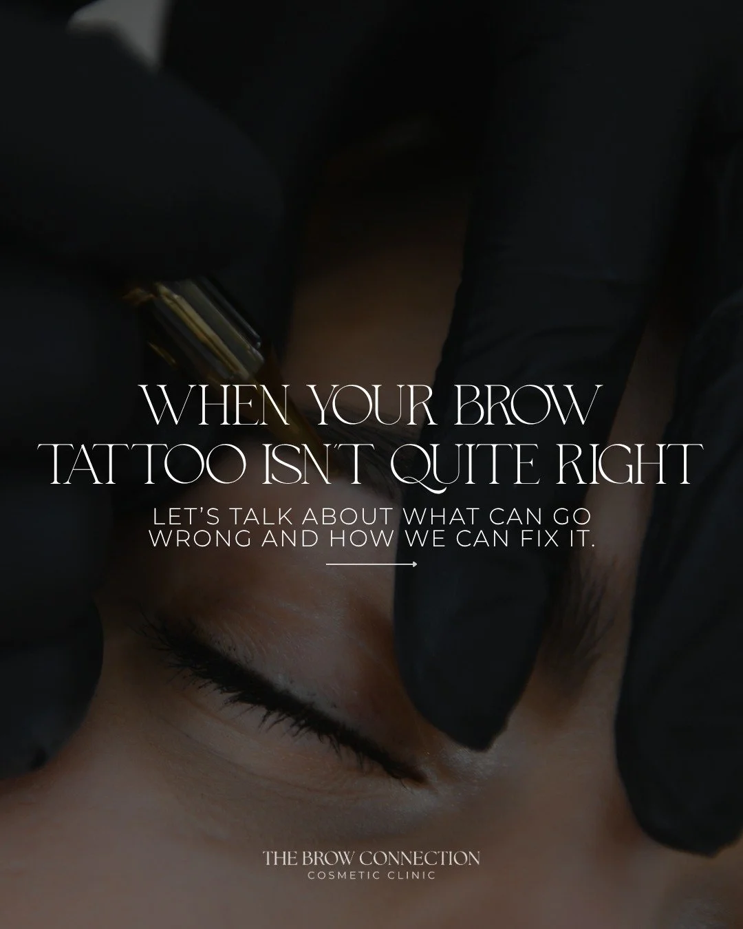 If your brows don’t feel like you anymore, you’re not alone. 
We see so many clients who come to us after a less-than-ideal brow tattoo experience brows that have turned too dark, uneven, or simply no longer match their features.
And ho