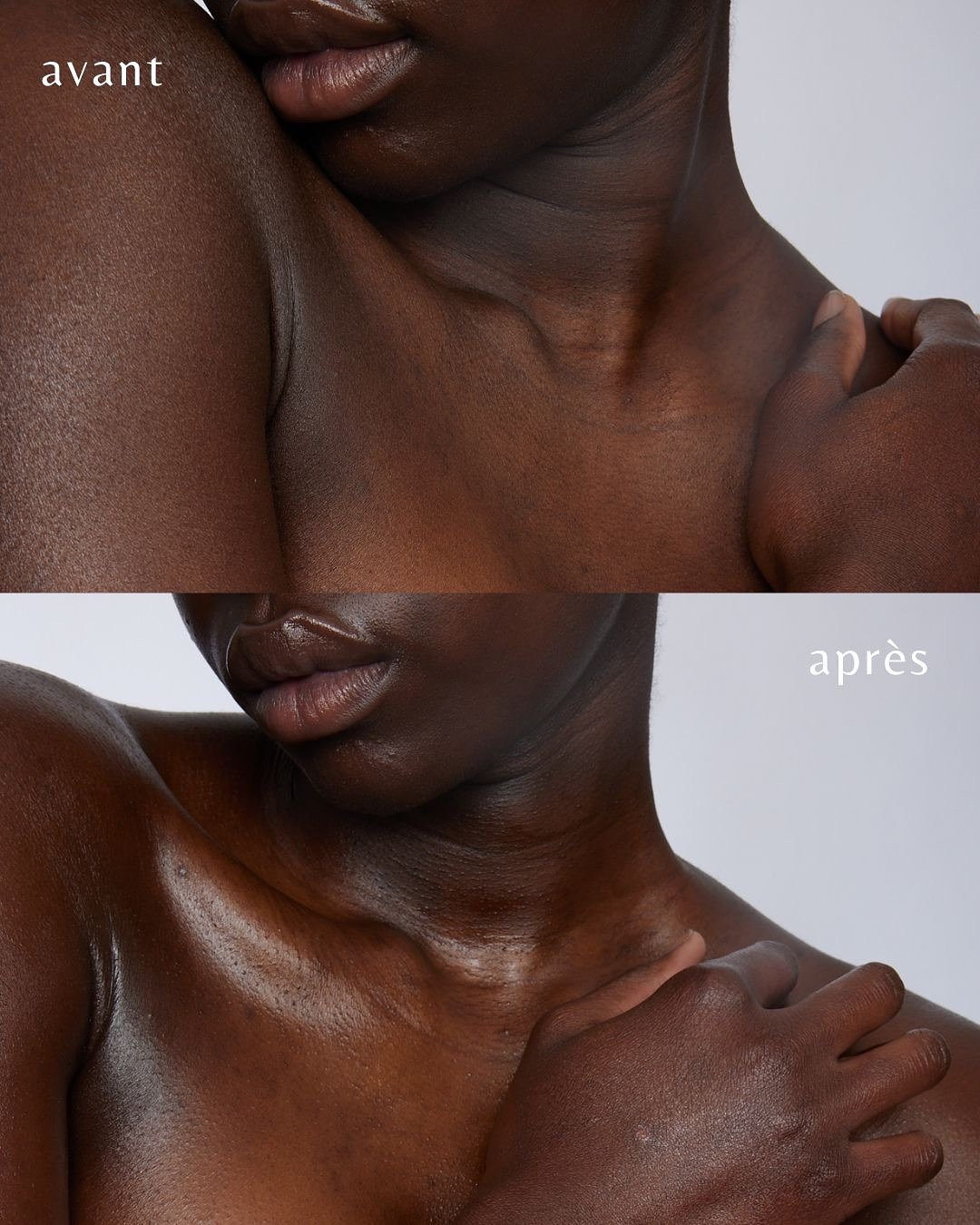 Instant glow. ✨

C&rsquo;est la saison du bronzage les filles !! Ne n&eacute;gligez pas notre huile nourrissante, qui saura apporter &agrave; votre peau l&rsquo;hydratation dont elle a besoin, tout en lui laissant une odeur sucr&eacute;e et un &eacut