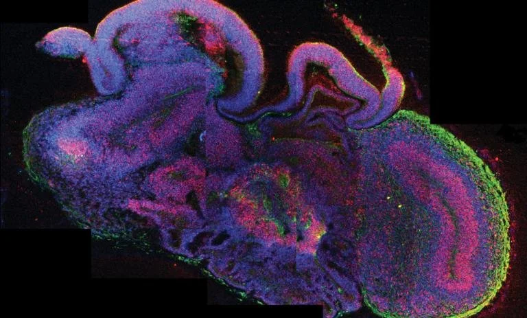 Organoides cerebrales humanos cultivados en una placa de laboratorio. Estos modelos tridimensionales permiten investigar etapas inaccesibles del desarrollo cerebral y podrían emplearse para estudiar enfermedades y probar nuevos medicamentos.