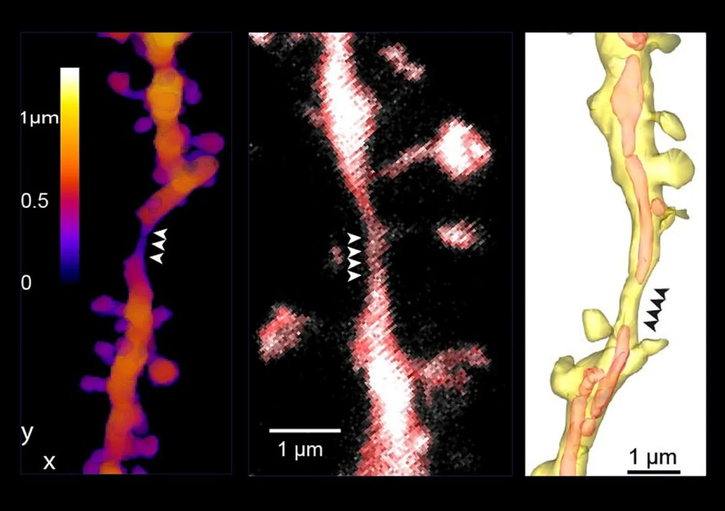 Ejemplos de constricciones del tallo dendrítico, señaladas con puntas de flecha y observadas mediante microscopía de expansión (izquierda), microscopía STED de superresolución (centro) y microscopía electrónica (derecha).