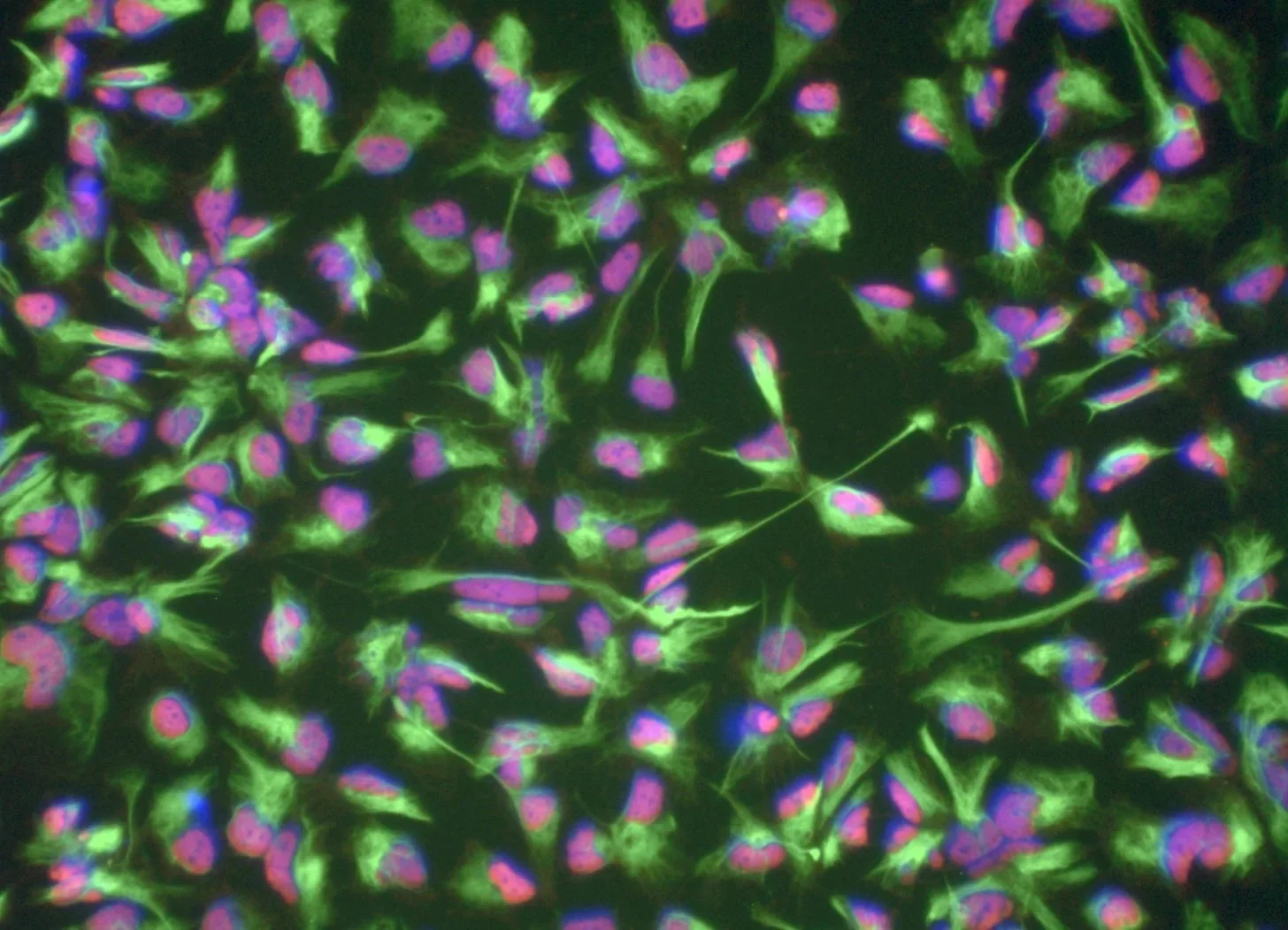 Células madre neurales inducidas (iNSCs), obtenidas mediante la reprogramación de células sanguíneas de un donante de 101 años.