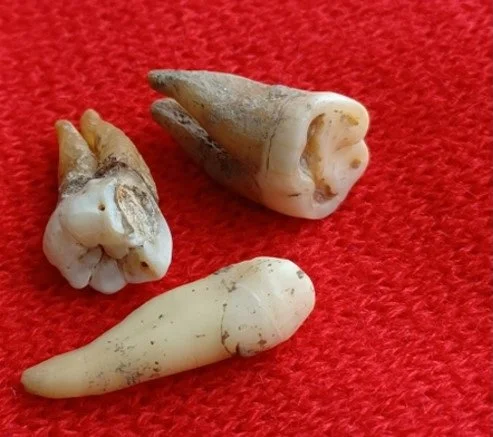 Teeth could preserve antibodies hundreds of years old