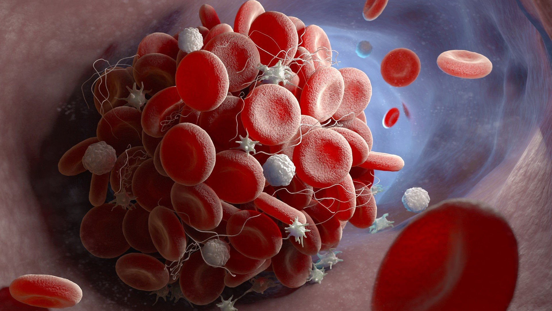 A new DNA drug to fight blood clots