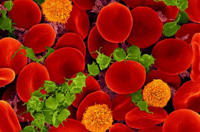 Mutations in blood stem cells can exacerbate colon cancer