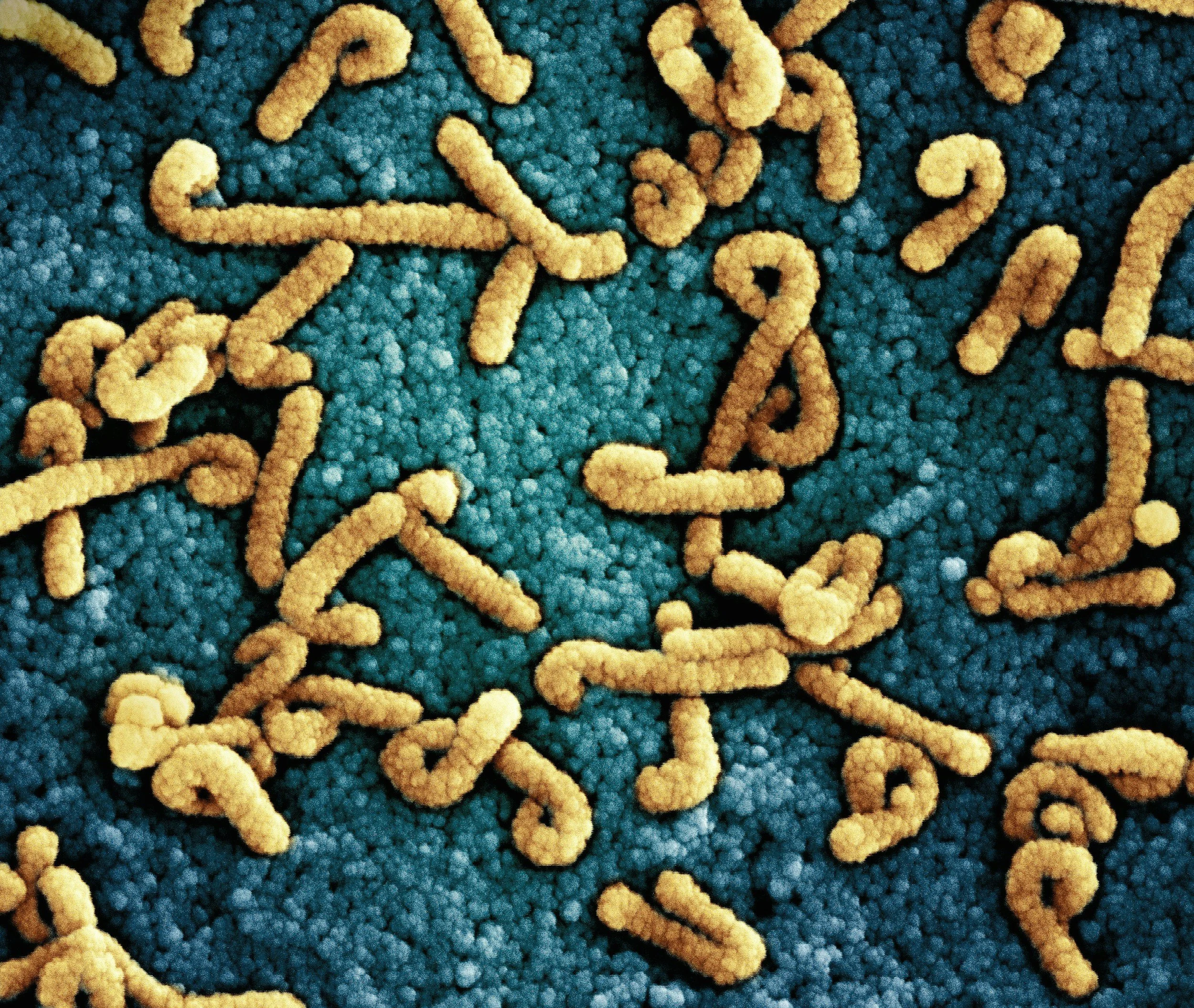 La cafeína puede interferir con la acción de antibióticos habituales frente a Escherichia coli (E. coli), una de las bacterias más comunes en el laboratorio y en infecciones humanas.