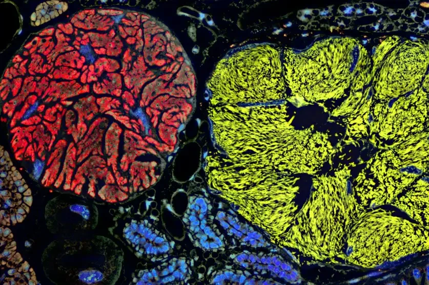 El microbio con el genoma más pequeño hasta la fecha redefine y amplía los límites de la vida