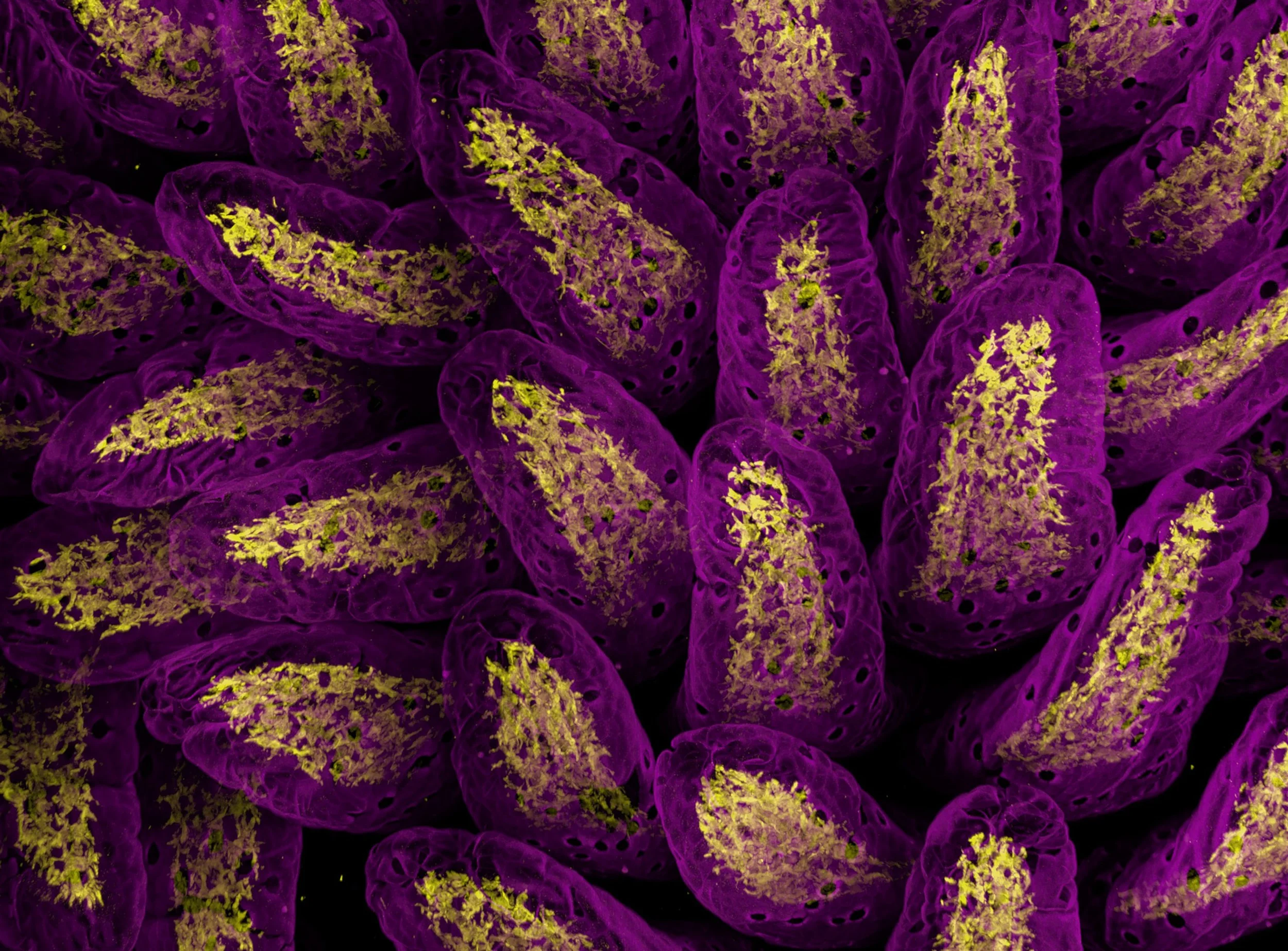 MERLIN, la inteligencia artificial que reconstruye la ubicación de las células inmunitarias en el riñón y el cerebro