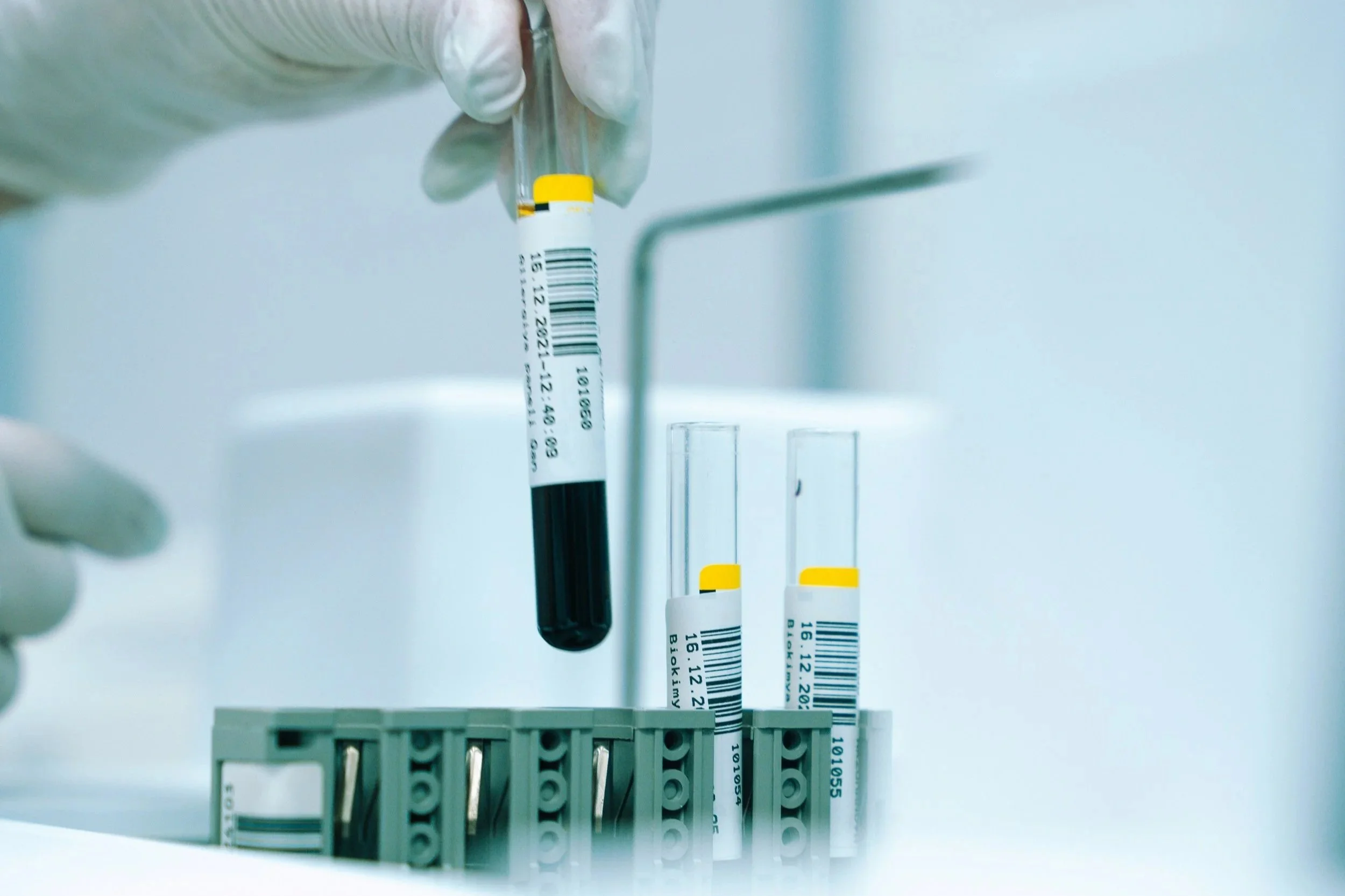 Un análisis de sangre puede predecir la demencia en mujeres hasta 25 años antes de los primeros síntomas