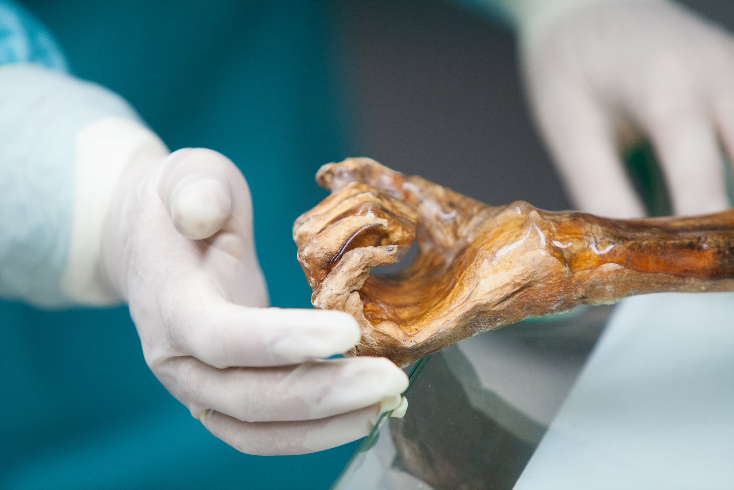 Los microbios de Ötzi despiertan 5.300 años después: hongos ancestrales amenazan la conservación del Hombre de Similaun