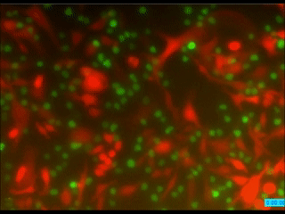 Una nueva generación de células inmunitarias abre vías inéditas para combatir el cáncer