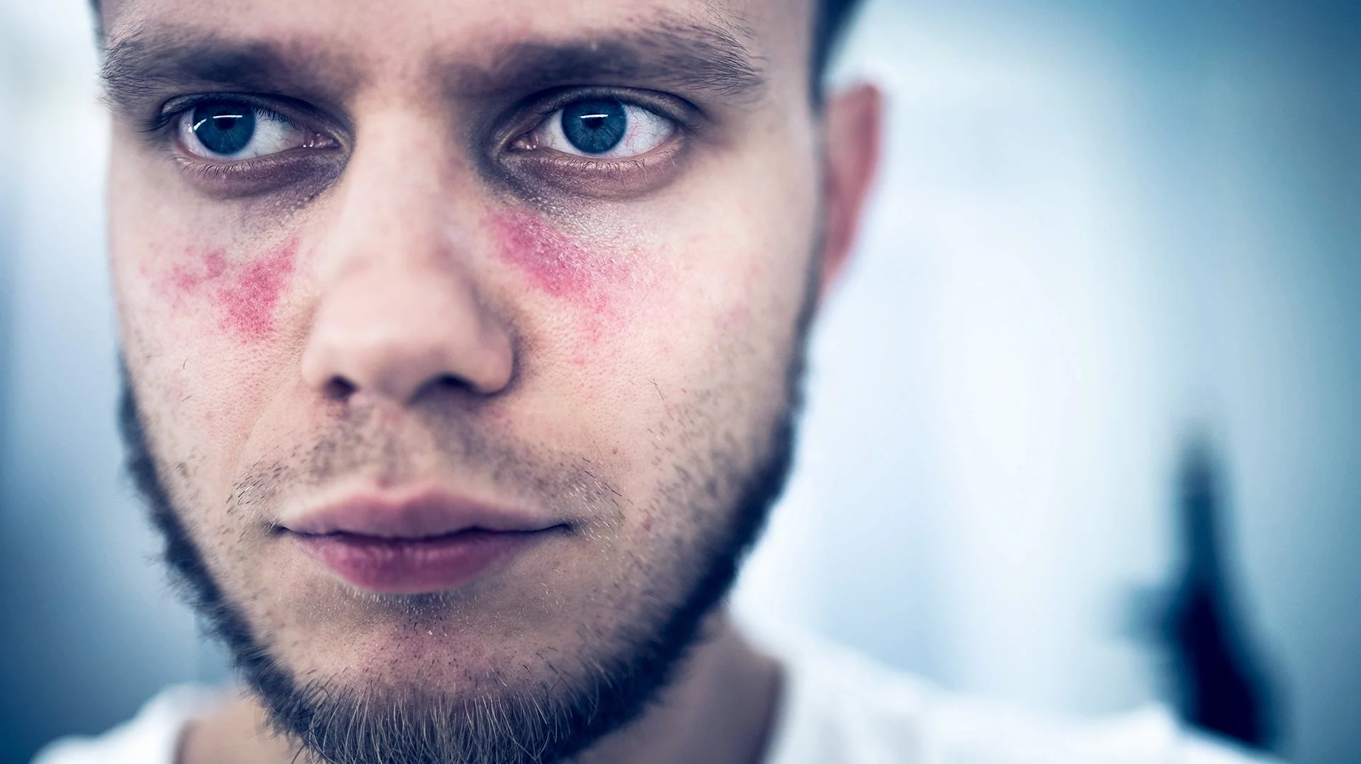 Un probiótico abre una inesperada vía para combatir el lupus