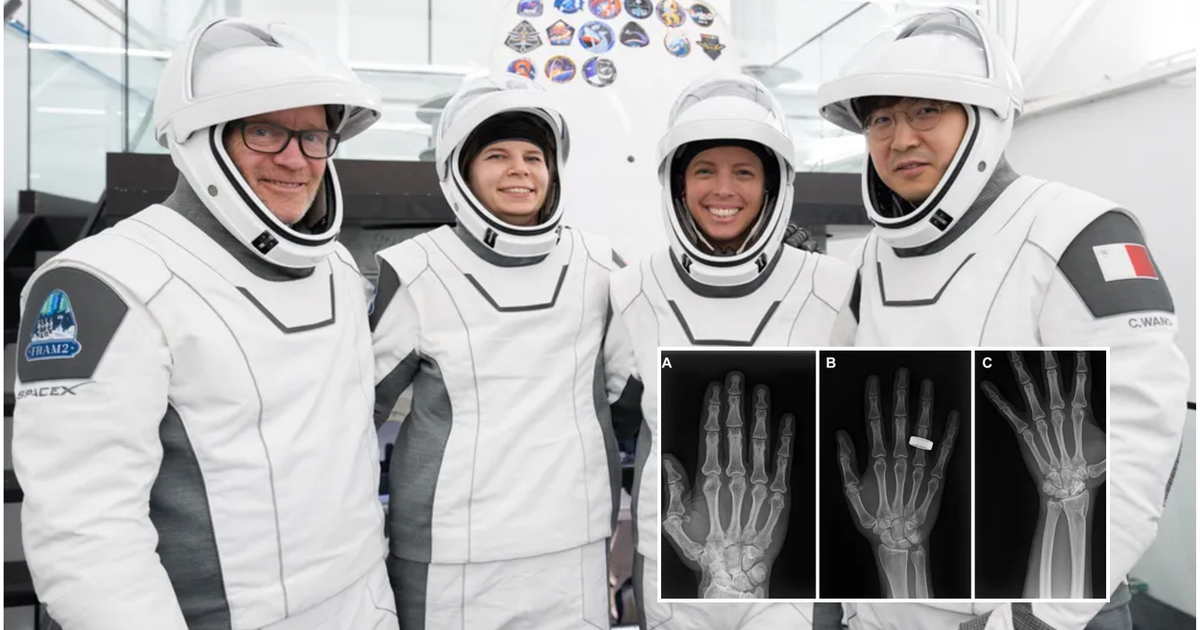 Las primeras radiografías en el espacio abren una nueva era para la medicina de los astronautas