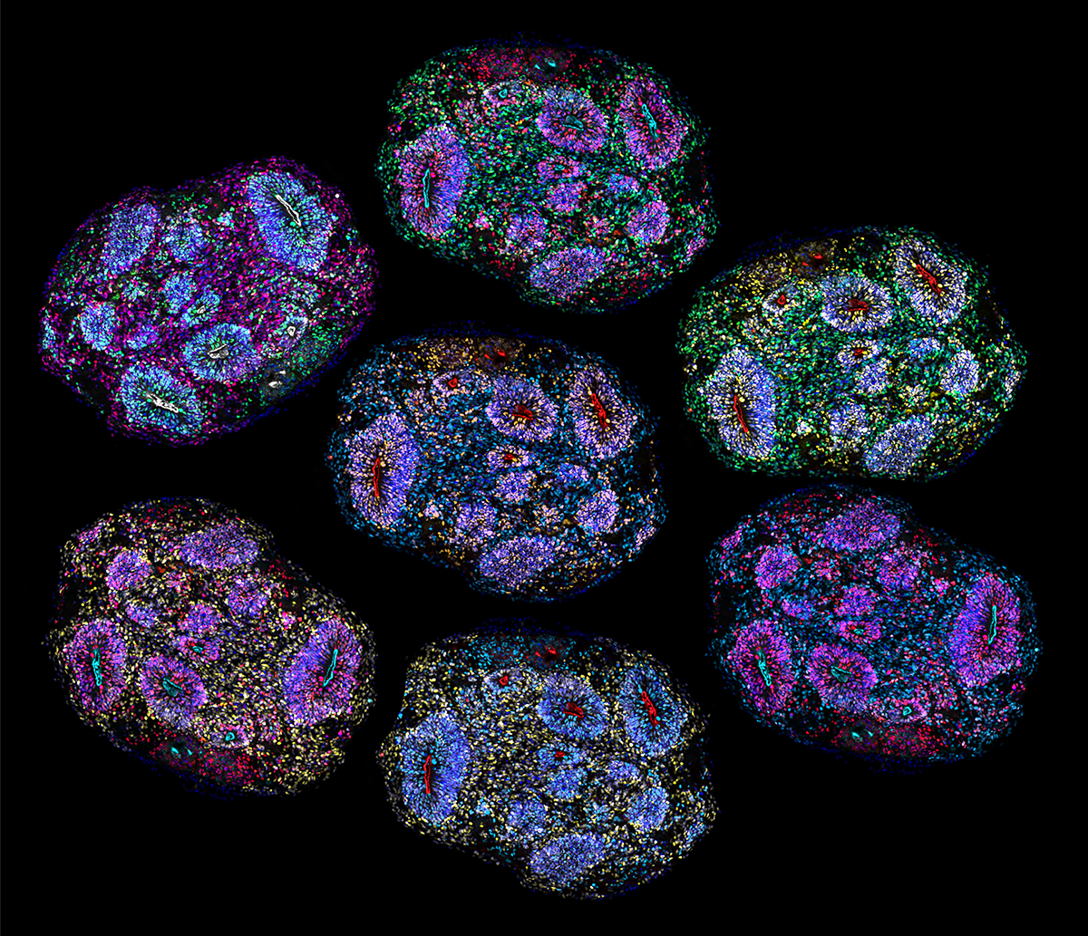 Los organoides cerebrales humanos más longevos «registran» el paso del tiempo