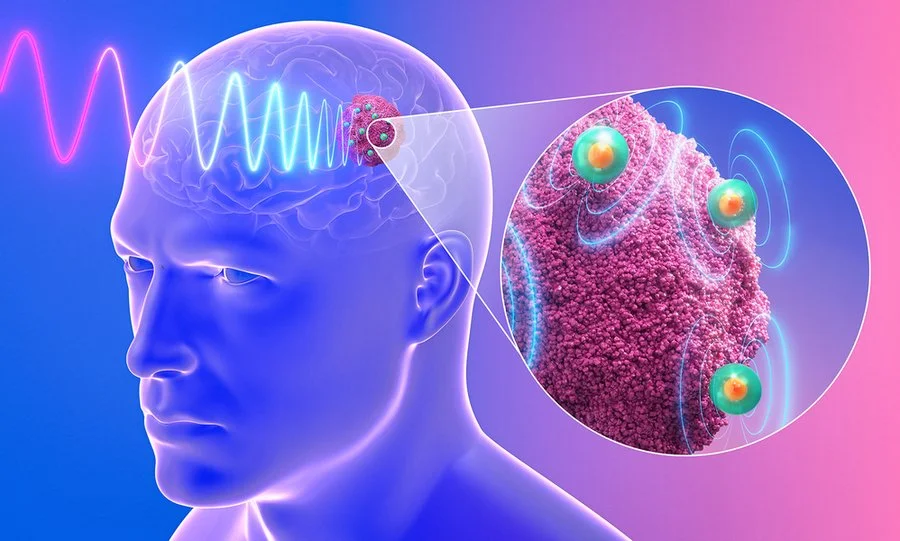 Unas nanoantenas  inyectables podrían ofrecer un tratamiento eficaz contra el glioblastoma resistente a los fármacos