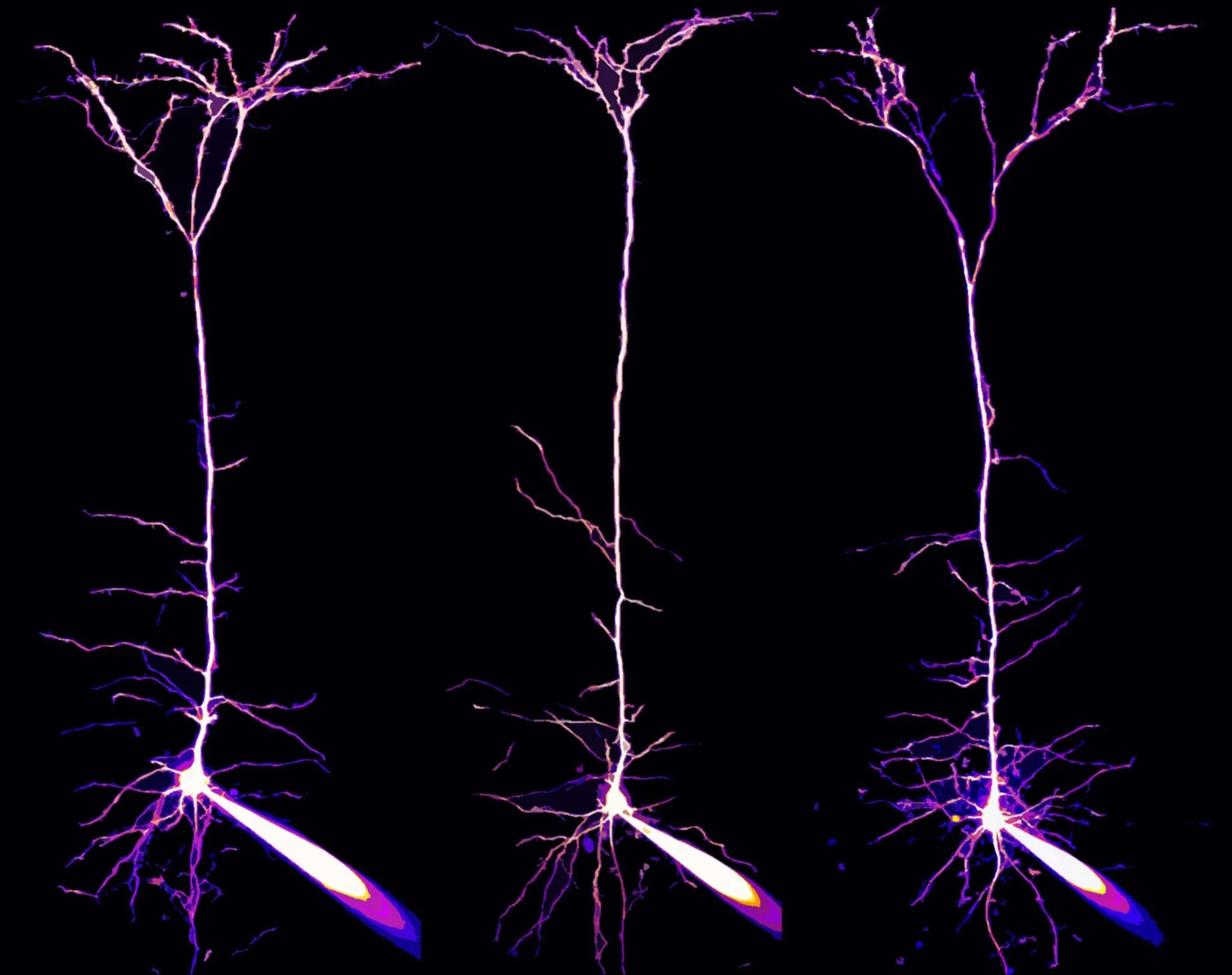 Descubren diminutos «cuellos de botella» en las neuronas que pueden cambiar cómo el cerebro procesa información 