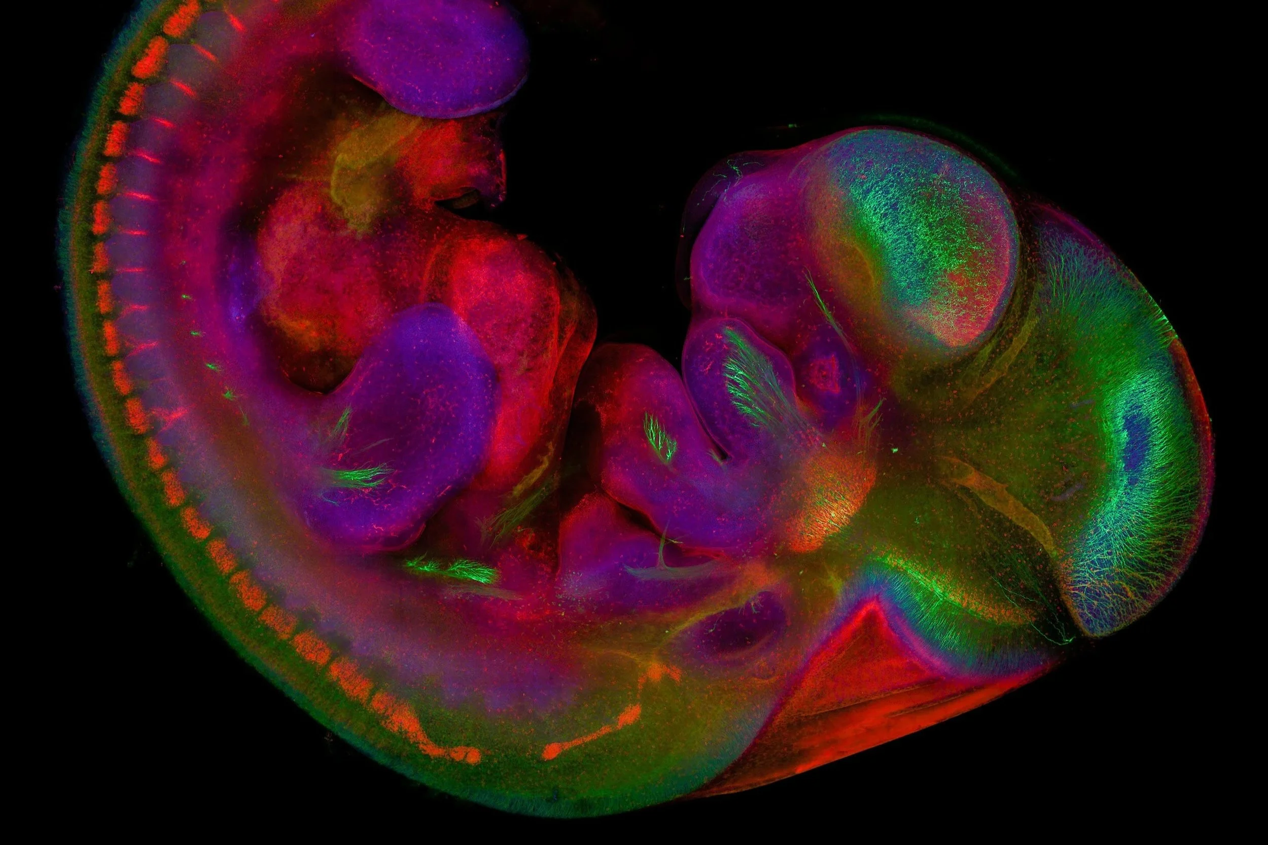 El cerebro humano conserva la huella de dos sistemas nerviosos primitivos que se fusionaron