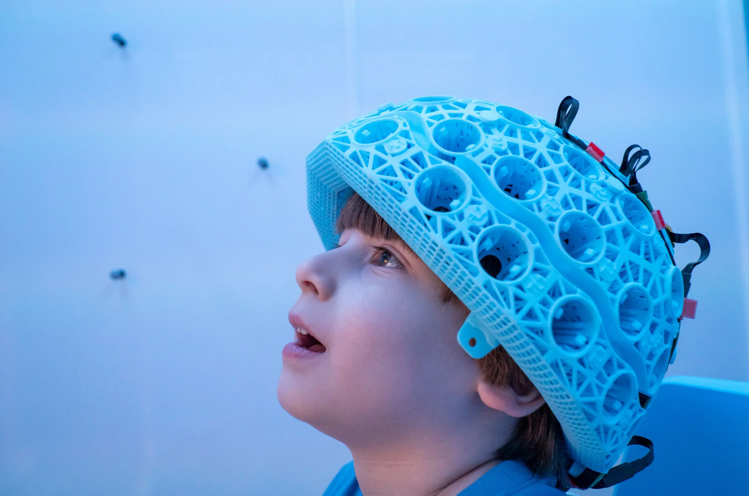 Una bolitas de tejido cerebral ayudan a desvelar las causas de la epilepsia infantil