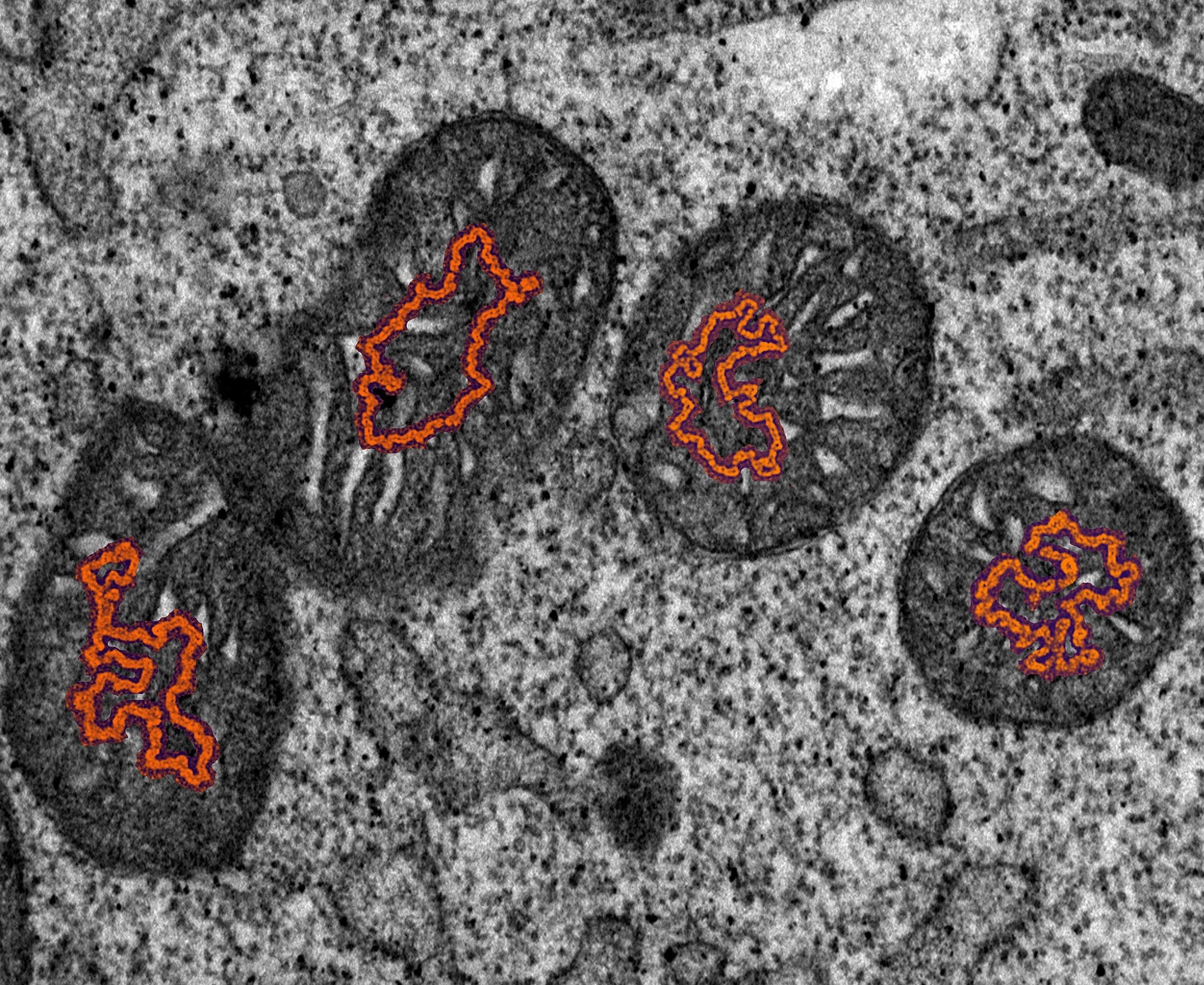 ADN mitocondrial y cáncer: cómo esta molécula puede influir en la progresión tumoral