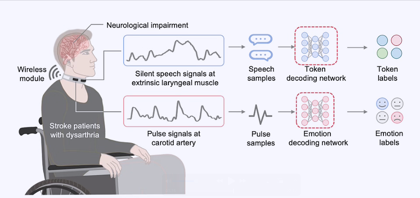 Revoice, un dispositivo vestible, cómodo y lavable, puede ayudar a recuperar una comunicación natural y fluida tras un ictus sin necesidad de implantes cerebrales invasivos.