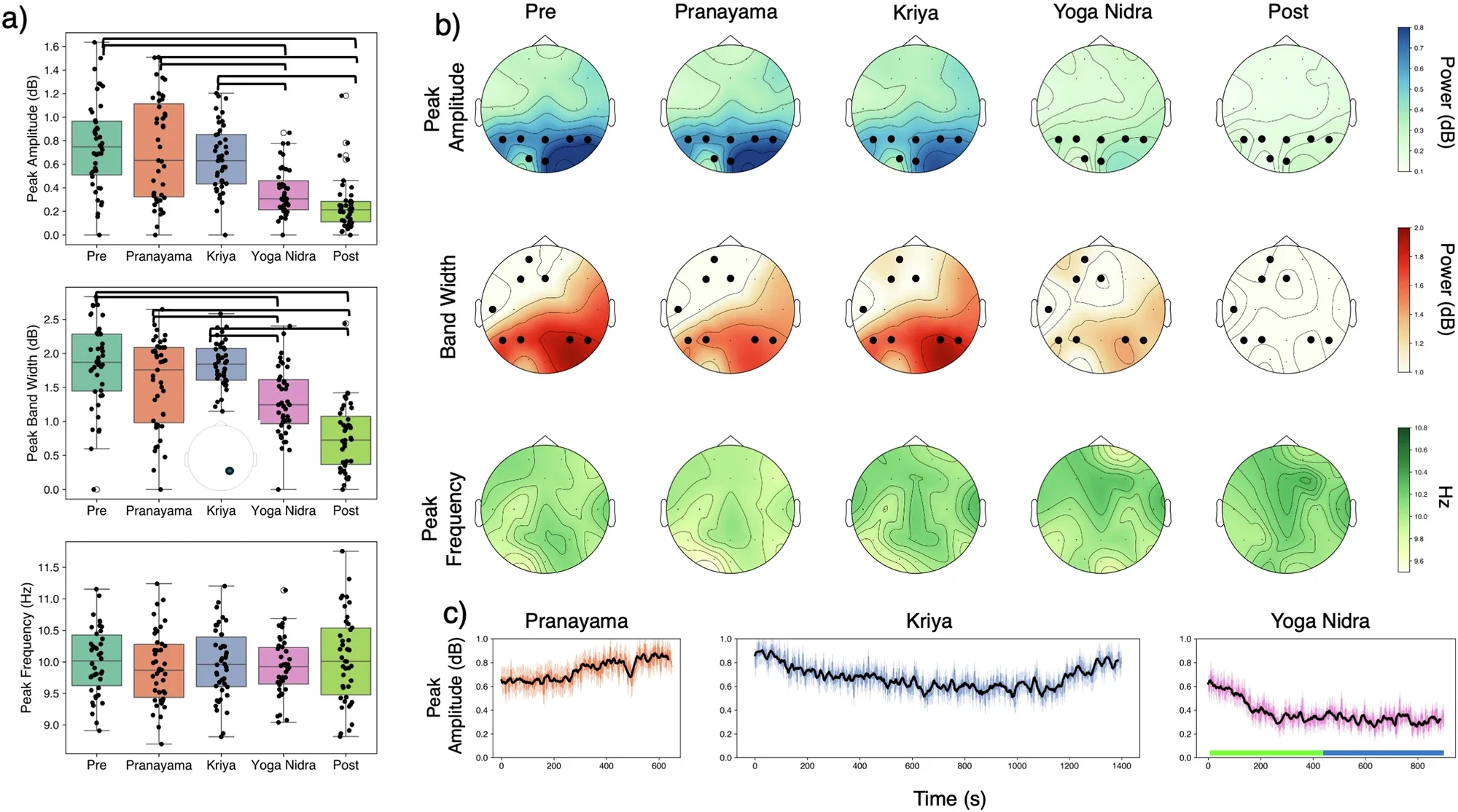 Efectos de la práctica del yoga Sudarshan Kriya en la dinámica de las ondas afa, asociadas a relajación y atención básica. Estas ondas caen en picado durante la fase de yoga nidra.
